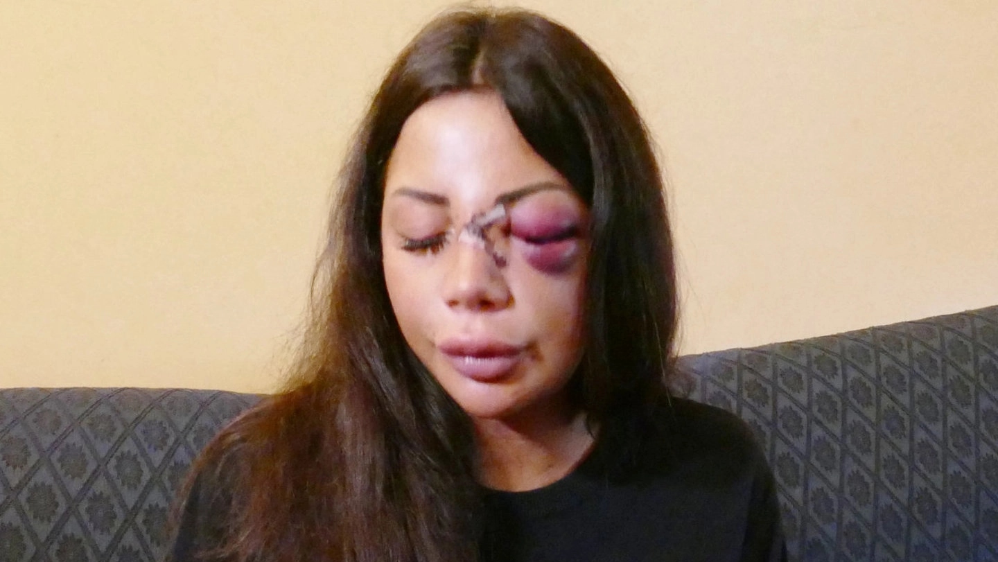 Martina Mucci il giorno dopo l’aggressione davanti a casa