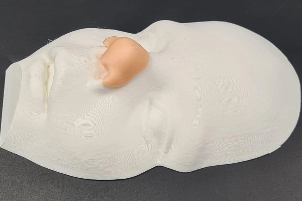 Il modello del naso stampato in 3D ricostruito sulla base del naso del gemello