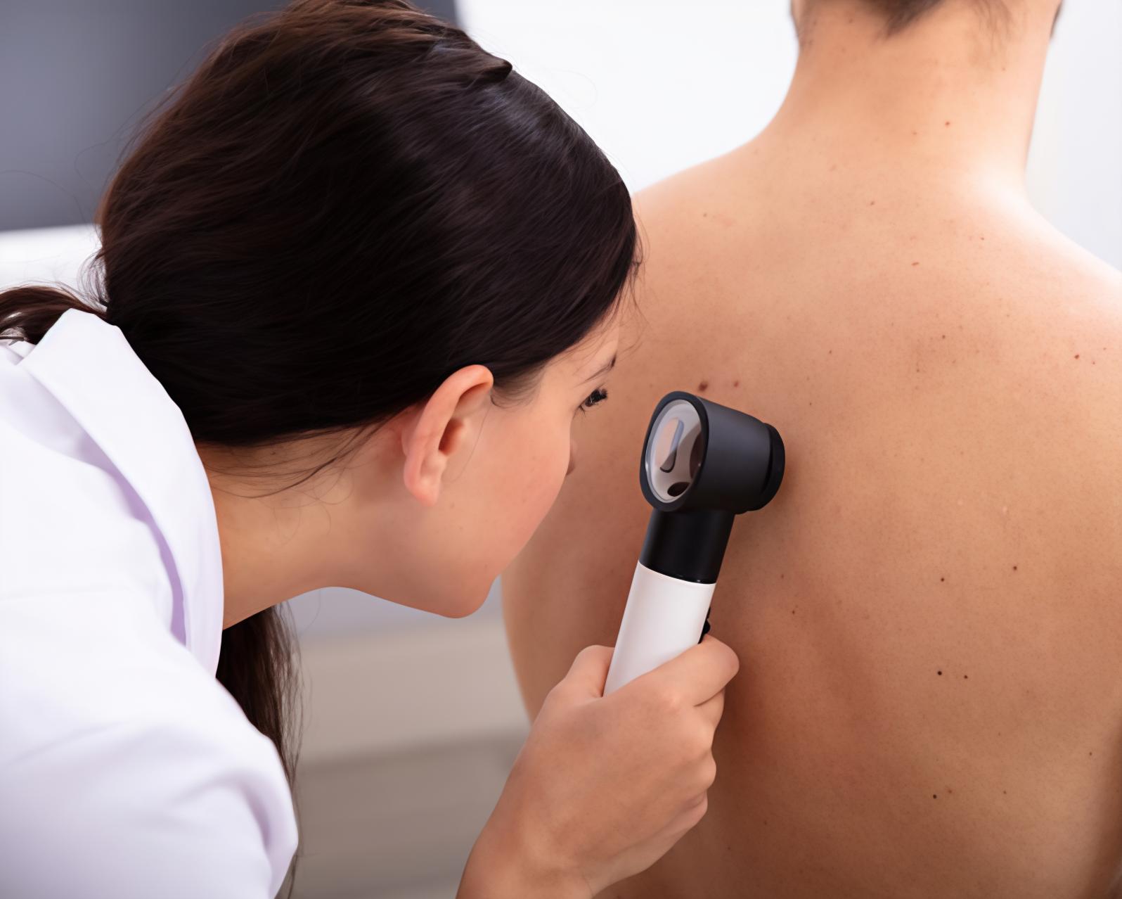 Melanoma, a Firenze visite oncologiche gratuite con Fondazione Ant